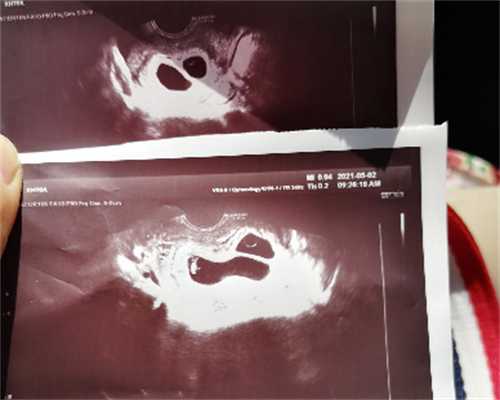 温州专业试管代怀 火热更新温州生殖医院名单公布，附2024最新供卵试管助孕指