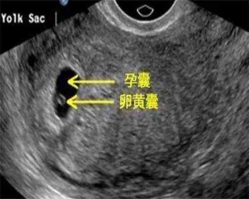 重庆找女人代怀多少钱 重庆市妇幼保健院生殖医学中心 ‘nt看男女上翘45’